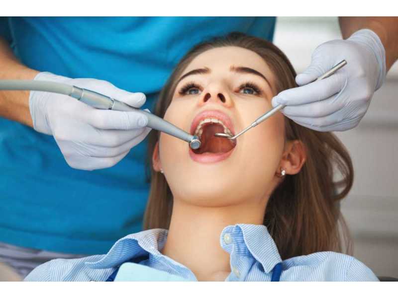 teeth-cleaning-in-nibm-pune-professional-dental-scaling-polishing-small-0