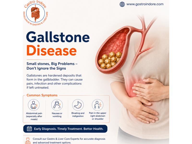 specialist-doctors-for-liver-in-indore-for-advanced-care-small-0