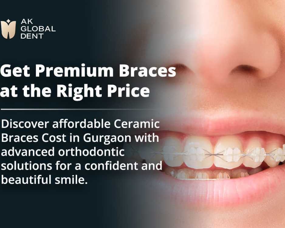 ceramic-braces-cost-in-gurgaon-smile-with-confidence