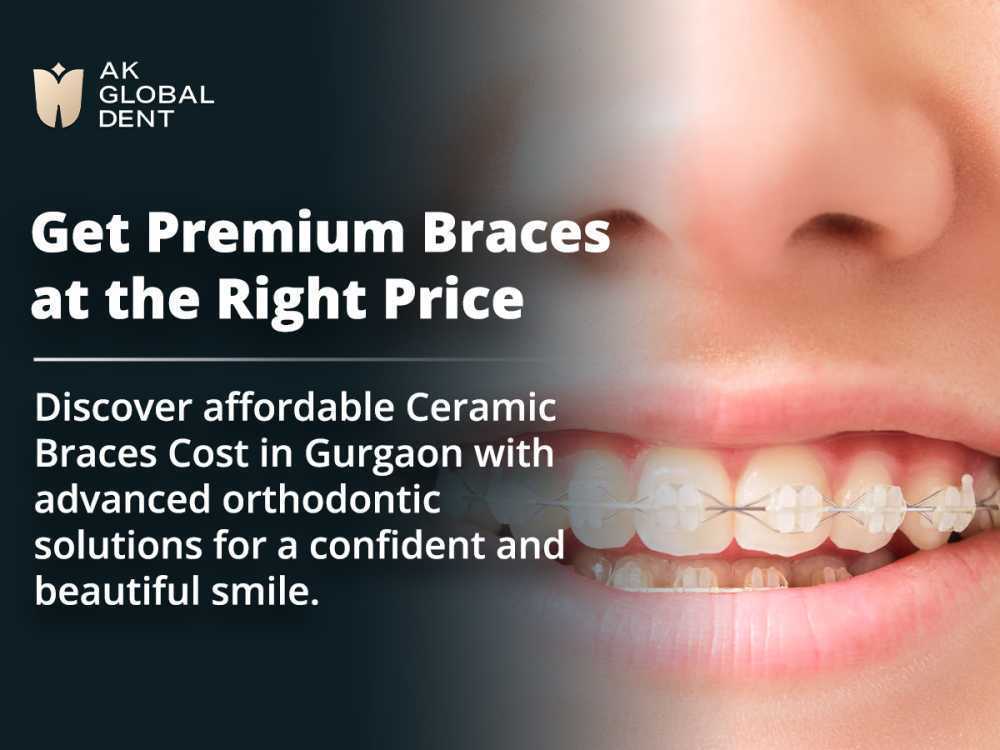 ceramic-braces-cost-in-gurgaon-smile-with-confidence-big-0