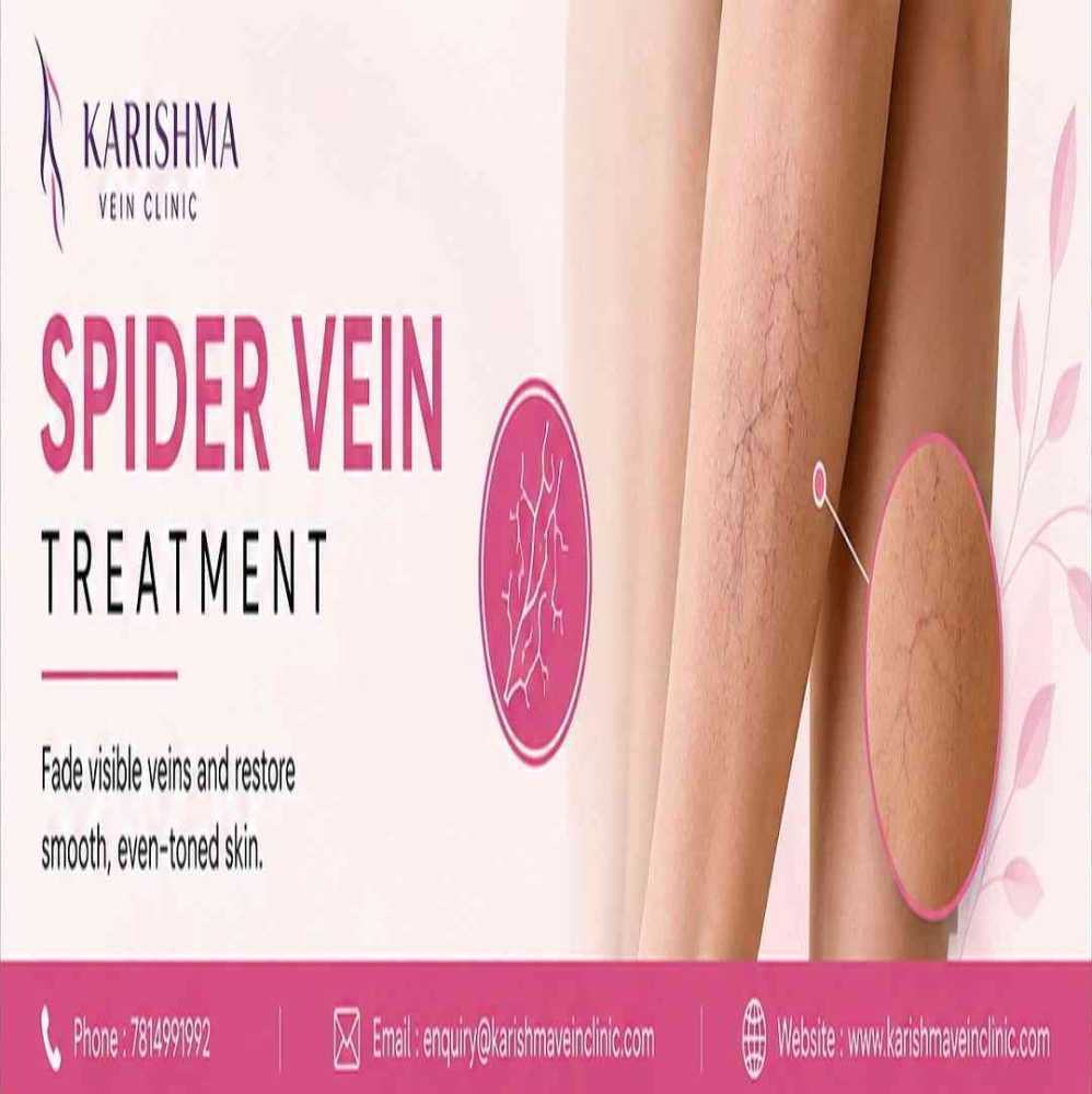 clear-skin-fast-spider-vein-treatment-in-pune-big-0