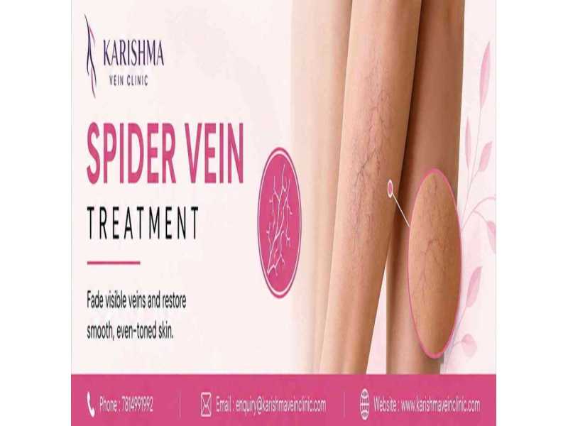 clear-skin-fast-spider-vein-treatment-in-pune-small-0
