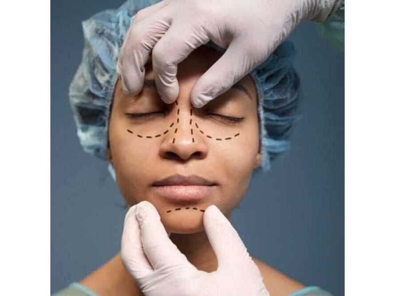 plastic-surgery-in-india-for-safe-natural-results-dr-anurag-bhargava-small-0