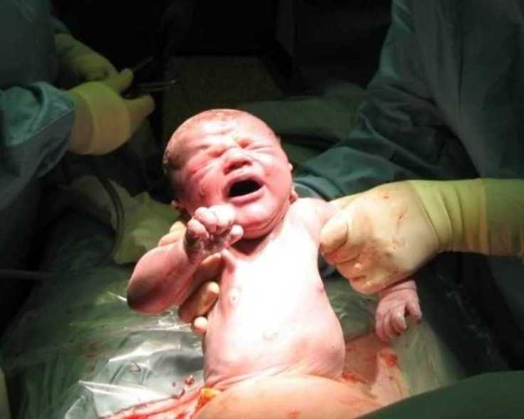 safe-cesarean-delivery-care-in-bhagalpur-bihar-for-mothers