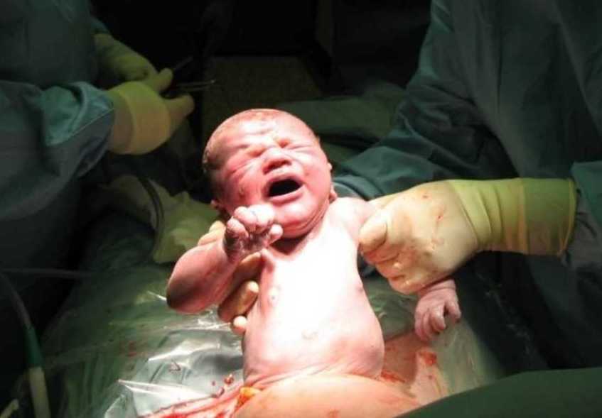 safe-cesarean-delivery-care-in-bhagalpur-bihar-for-mothers-big-0