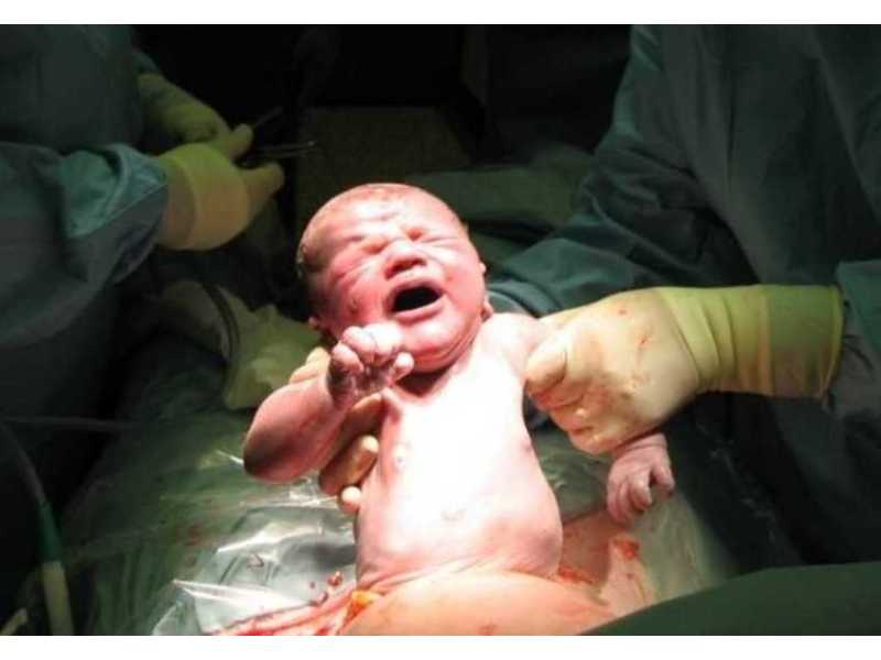safe-cesarean-delivery-care-in-bhagalpur-bihar-for-mothers-small-0