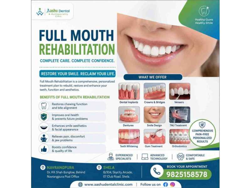 full-mouth-rehabilitation-in-navrangpura-dr-manish-shah-small-0
