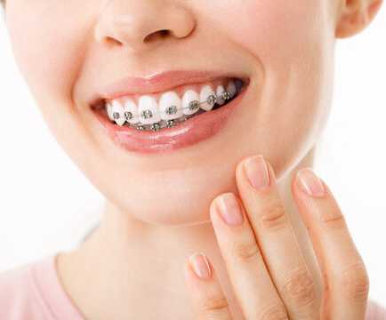 affordable-braces-treatment-in-pune-from-rs29999-emi-available-big-0