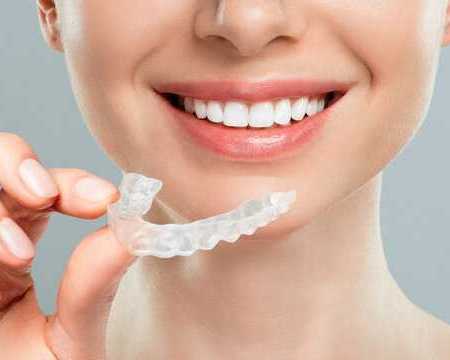 invisalign-aligners-in-pune-starting-at-rs49500-book-appointment