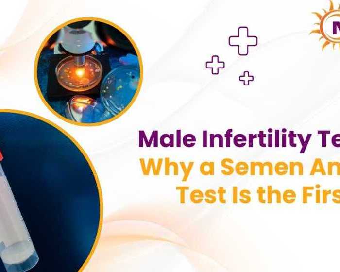 male-infertility-testing-why-a-semen-analysis-test-is-the-first-step