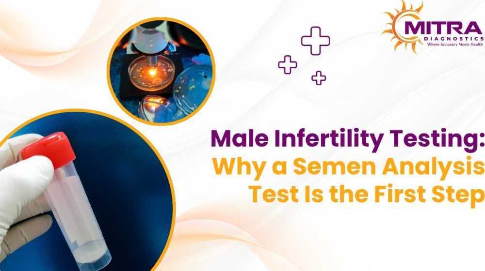 male-infertility-testing-why-a-semen-analysis-test-is-the-first-step-big-0