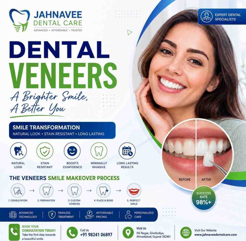 cosmetic-dental-veneers-treatment-jahnavee-dental-care-big-0