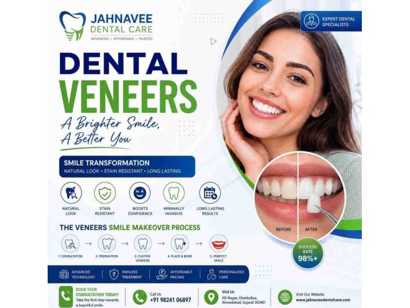 cosmetic-dental-veneers-treatment-jahnavee-dental-care-small-0