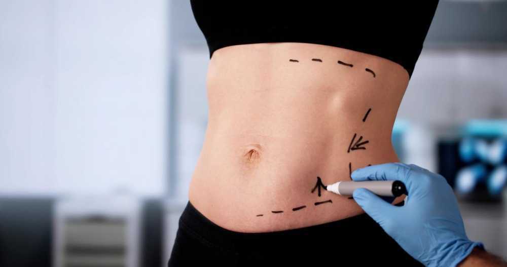 advanced-abdominoplasty-in-mumbai-natural-results-big-0