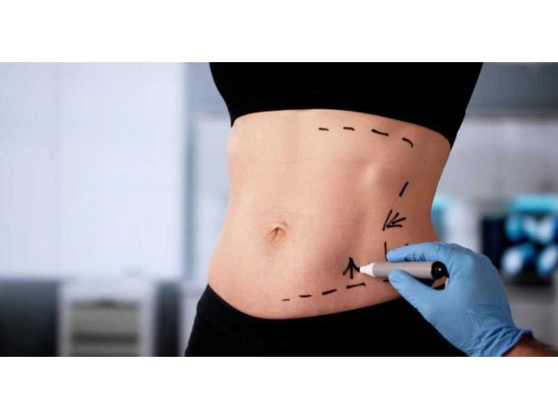 advanced-abdominoplasty-in-mumbai-natural-results-small-0