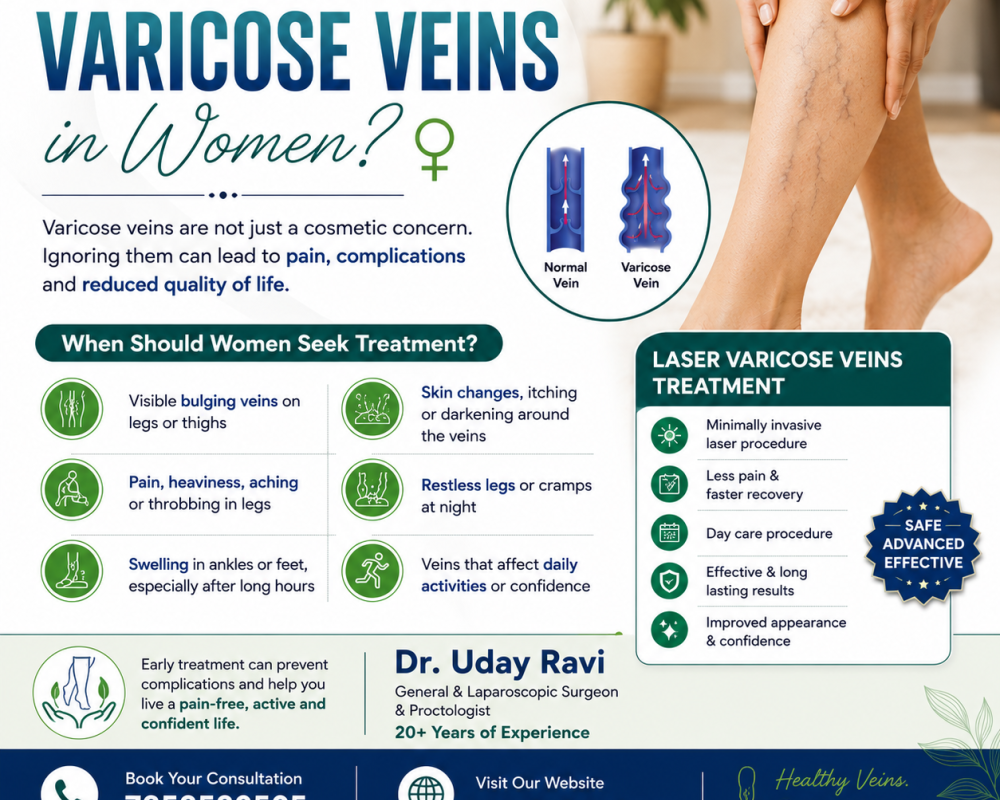 when-should-women-seek-treatment-for-varicose-veins-dr-uday-ravi