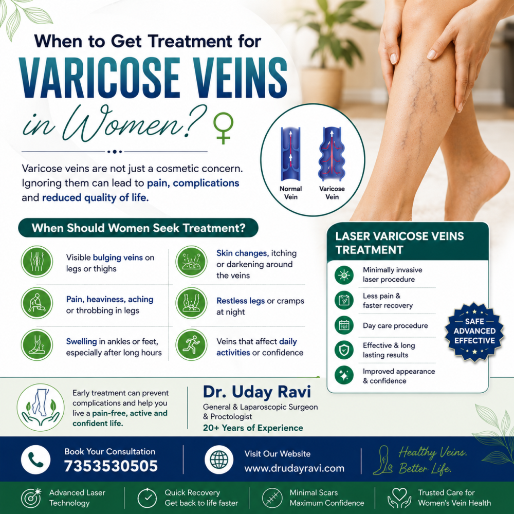 when-should-women-seek-treatment-for-varicose-veins-dr-uday-ravi-big-0