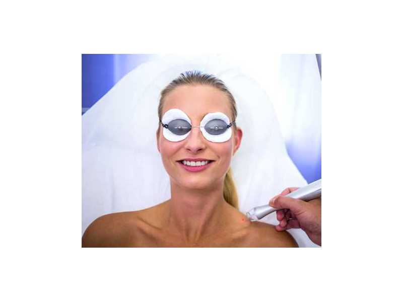 dark-spots-on-face-treatment-expert-pigmentation-care-at-auguste-skin-small-0