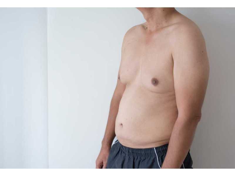 best-gynecomastia-surgery-in-mumbai-by-experienced-surgeons-small-0