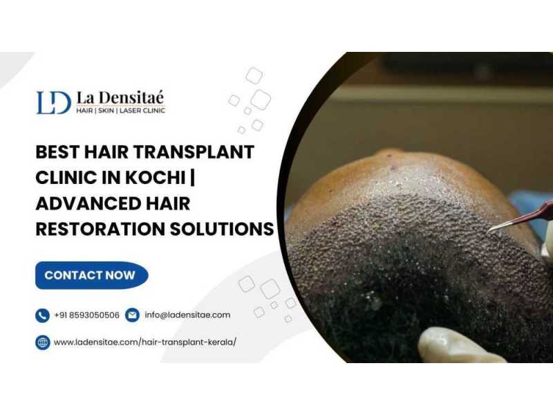 best-hair-transplant-clinic-in-kochi-advanced-hair-restoration-solutions-small-0