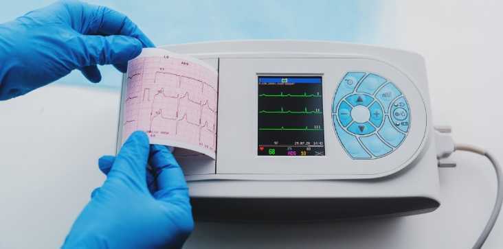can-remote-ecg-diagnostics-help-me-send-my-report-to-him-in-real-time-big-0