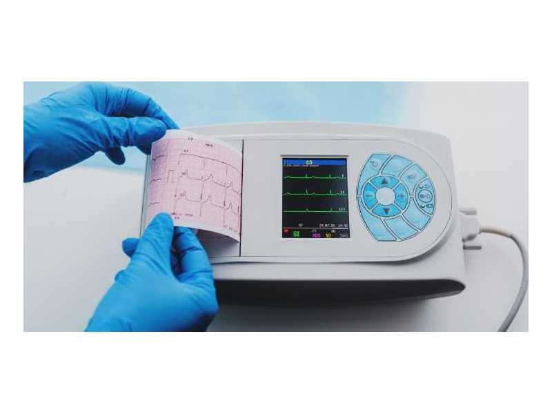 can-remote-ecg-diagnostics-help-me-send-my-report-to-him-in-real-time-small-0