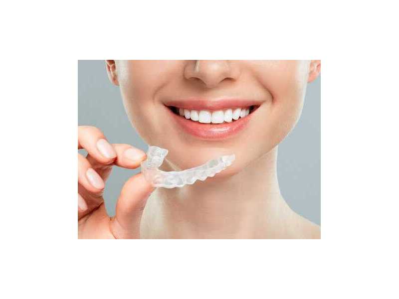 affordable-invisalign-treatment-in-pune-from-rs49500-book-consultation-small-0