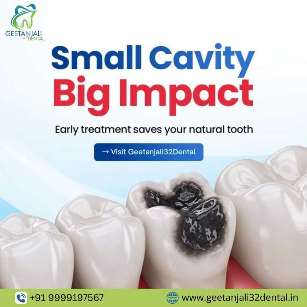 best-dentist-near-gaur-city-for-reliable-and-professional-care-big-0