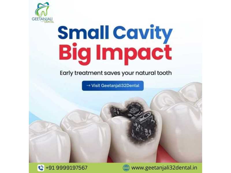 best-dentist-near-gaur-city-for-reliable-and-professional-care-small-0