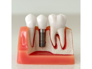 What are common cosmetic dentistry procedures?