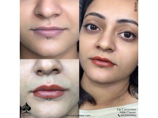 Best Lip Correction Treatment in Mumbai - Ace Tattooz & Art Studio