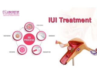 Affordable IUI Treatment in Bangalore - Low Cost IVF Treatment