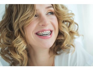 Transform Your Smile The Ultimate Guide To Dental Braces Treatment In Thane With Smile Wellness