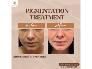 Get the Best Pigmentation Treatment in Gurgaon