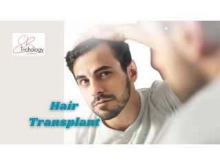 Hair Transplant In Gurgaon at SB Trichology