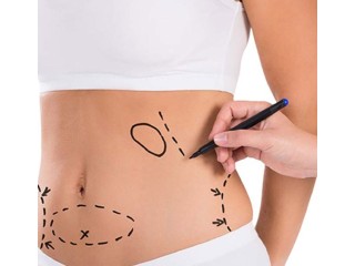"Trim Your Waistline with Our Expert Tummy Tuck Surgery in Jaipur!"