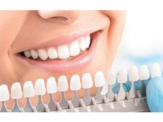 Best Teeth Whitening Service Doctors in Ahmedabad | 9825158578