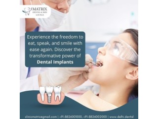 Why Should I Consider Dental Implant Services in Delhi?