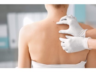 Best Skin Specialist for Tag Removal Treatment in Faridabad - Revyve Care