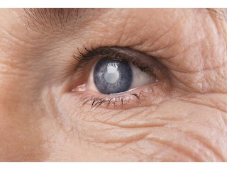 Is Glaucoma Disease Infected Lifelong?