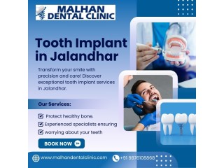 Transform Your Smile: Experience Tooth Implants in Jalandhar with Malhan Dental Clinic