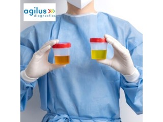 Make an appointment for Agilus Diagnostics' Catecholamine Urine Test.