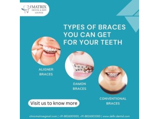 Find the Best Orthodontist in Delhi for Your Treatment Needs