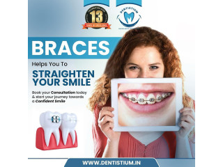 Achieve a Perfect Smile with Aligners from Dentistium!