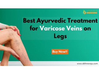 Get Ayurvedic Medicine for Varicose Veins and Spider Veins