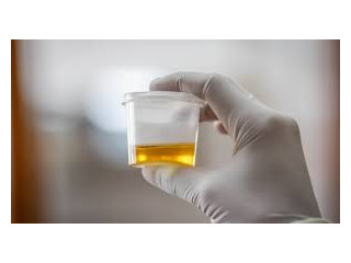 Leading Urine Sample Collection Service in Hyderabad