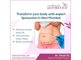 Dr. Vinod Vij: Pioneering Liposuction in Navi Mumbai for Over 25 Years