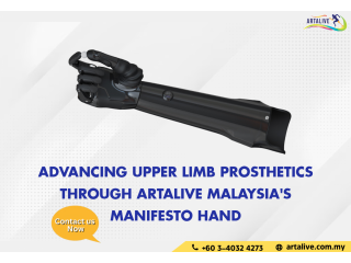 Advancing Upper Limb Prosthetics through Artalive Malaysia's Manifesto Hand