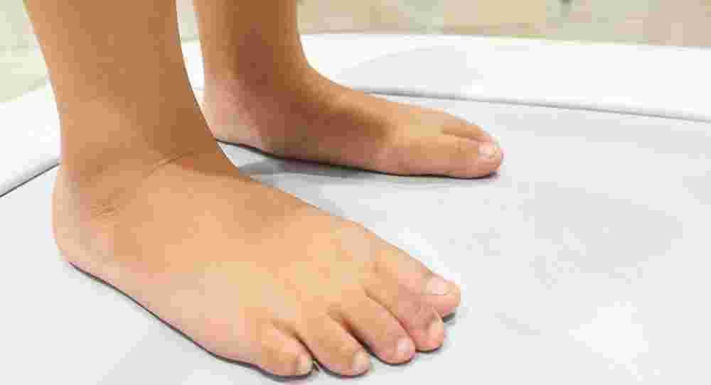 flat-foot-treatment-singapore-by-certified-podiatrists-big-0
