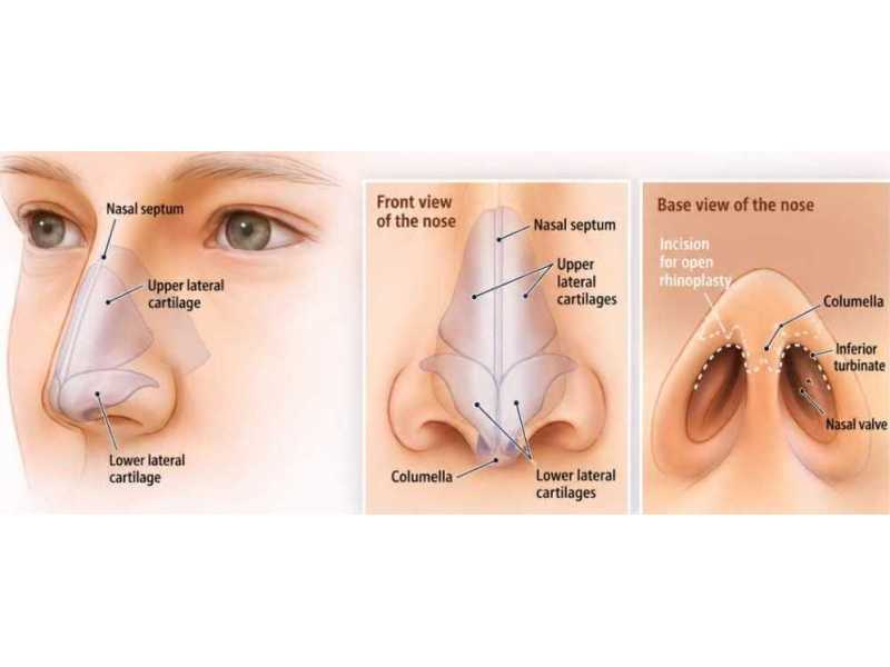 looking-for-nose-plastic-surgery-in-singapore-book-now-small-0